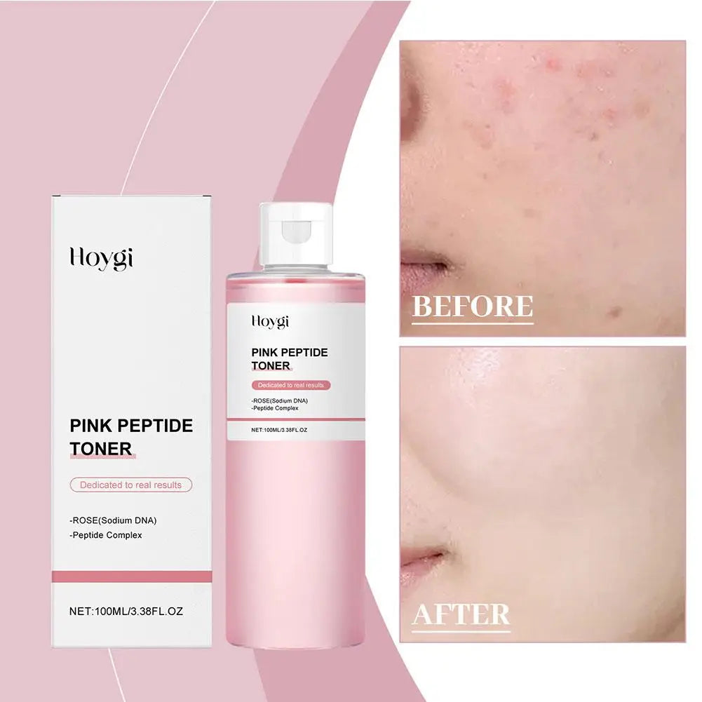 Rose Toner Moisturizing Nourishing Improve Dryness Oil Control Whitening Serum Refresh Elastic Shrink Pores Korean Skin Care